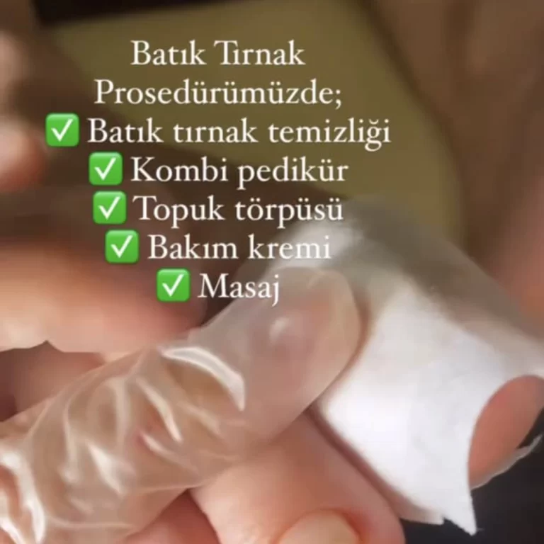 Hulya sonay batık tırnak